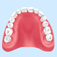 プラスチック義歯
